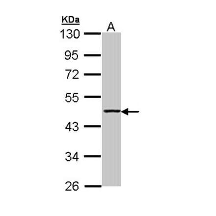 Aminoacylase-1 antibody from Signalway Antibody (22151) - Antibodies.com