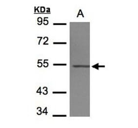 beta IV Tubulin antibody from Signalway Antibody (22498) - Antibodies.com