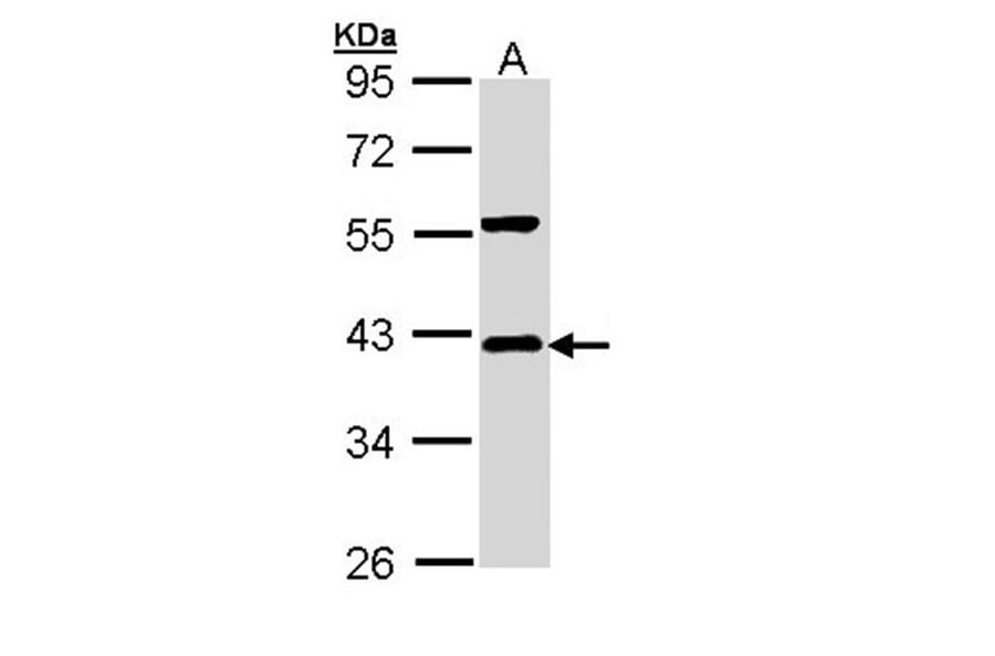 I kappa B-alpha antibody from Signalway Antibody (23045) - Antibodies.com