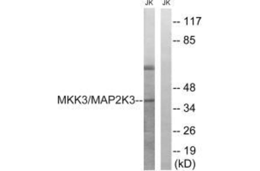 Western blot - MAP2K3 (Ab-222) Antibody from Signalway Antibody (33236) - Antibodies.com