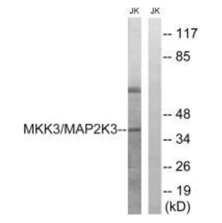 Western blot - MAP2K3 (Ab-222) Antibody from Signalway Antibody (33236) - Antibodies.com
