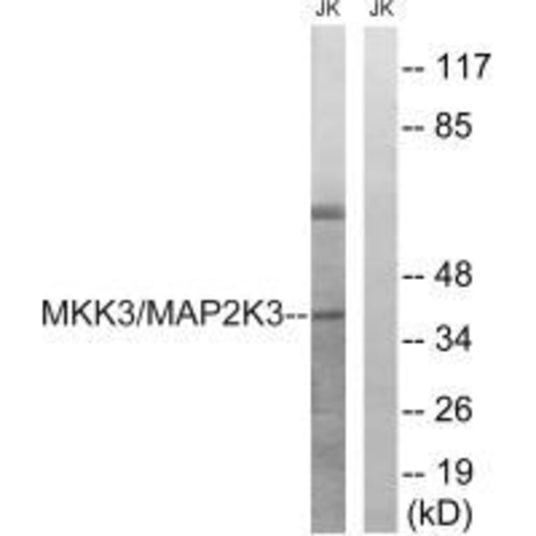 Western blot - MAP2K3 (Ab-222) Antibody from Signalway Antibody (33236) - Antibodies.com