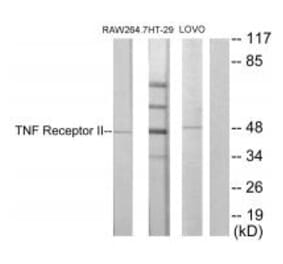 Western blot - TNF Receptor II Antibody from Signalway Antibody (33710) - Antibodies.com