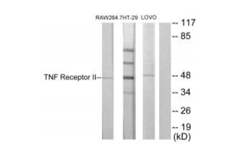 Western blot - TNF Receptor II Antibody from Signalway Antibody (33710) - Antibodies.com