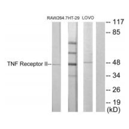 Western blot - TNF Receptor II Antibody from Signalway Antibody (33710) - Antibodies.com