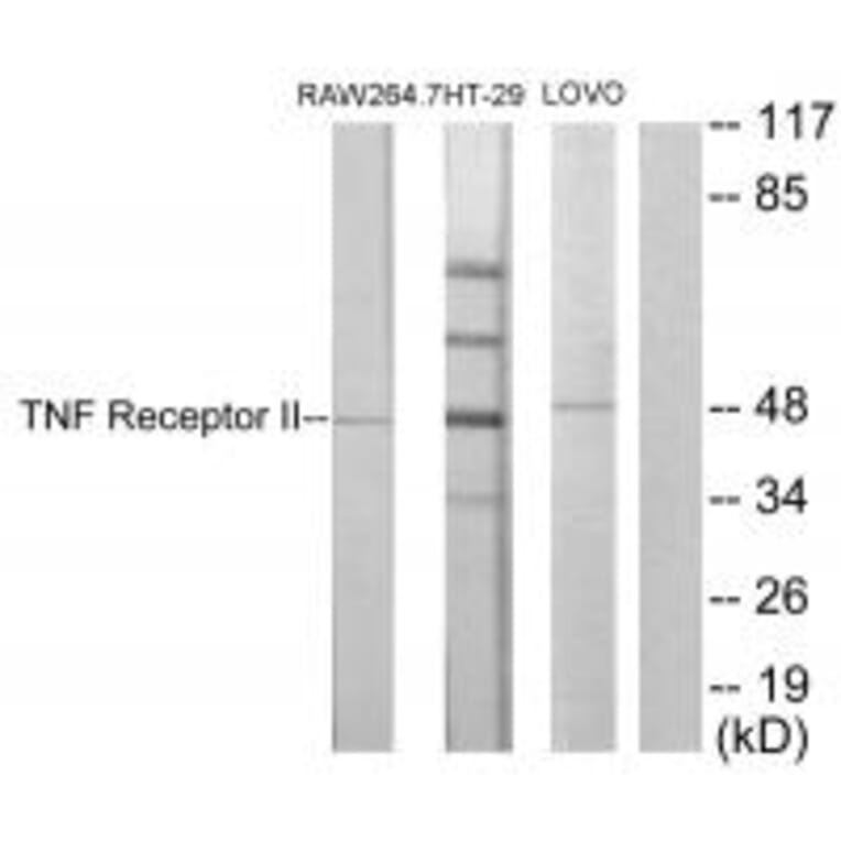 Western blot - TNF Receptor II Antibody from Signalway Antibody (33710) - Antibodies.com