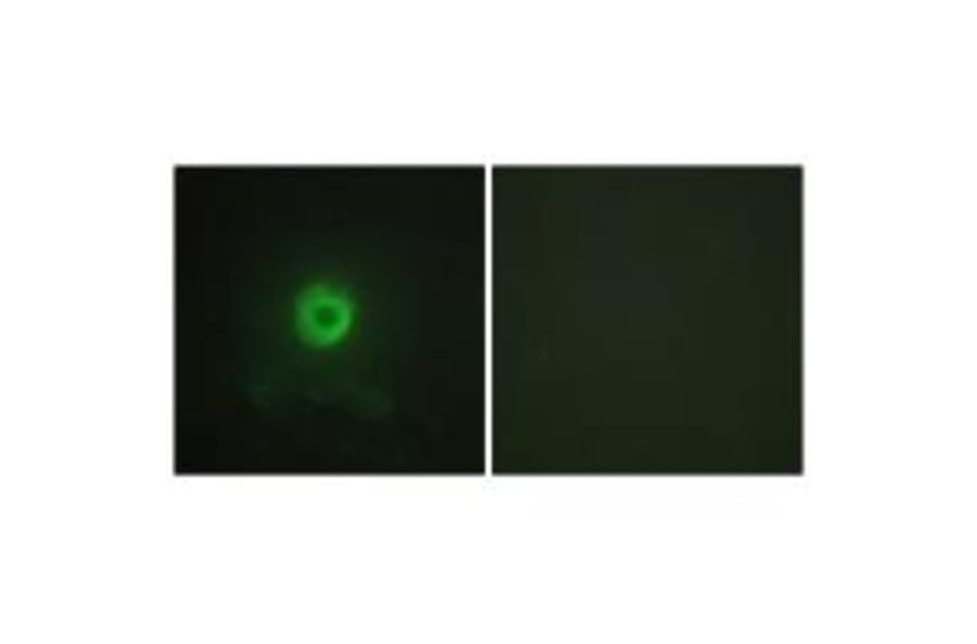 Immunofluorescence - TNF Receptor II Antibody from Signalway Antibody (33710) - Antibodies.com