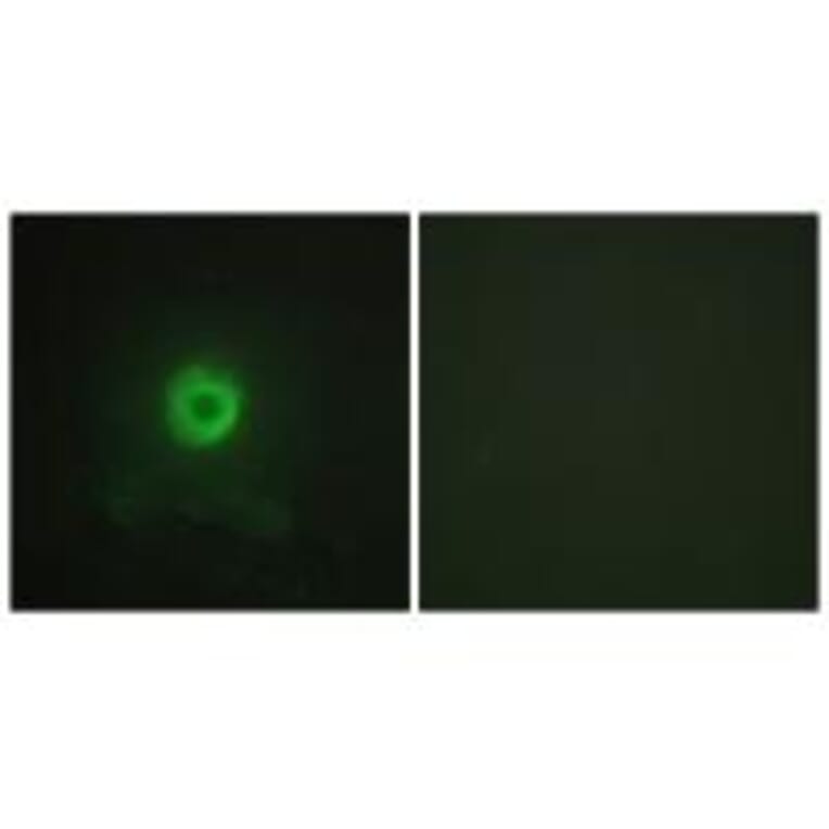 Immunofluorescence - TNF Receptor II Antibody from Signalway Antibody (33710) - Antibodies.com