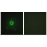 Immunofluorescence - TNF Receptor II Antibody from Signalway Antibody (33710) - Antibodies.com