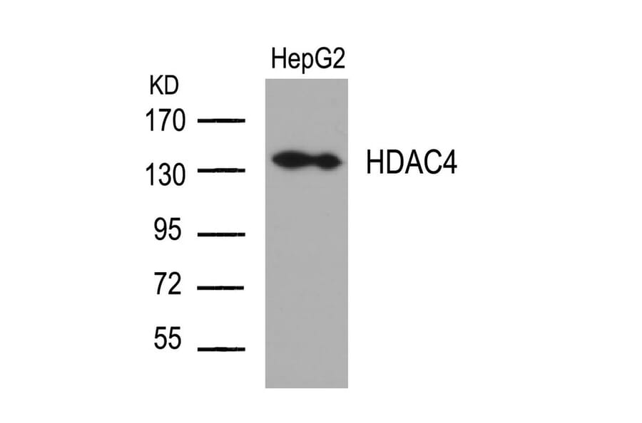 Western blot - HDAC4 (Ab-632) Antibody from Signalway Antibody (21141) - Antibodies.com