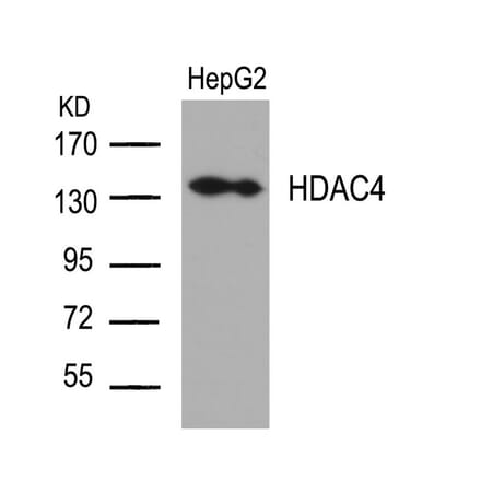 Western blot - HDAC4 (Ab-632) Antibody from Signalway Antibody (21141) - Antibodies.com