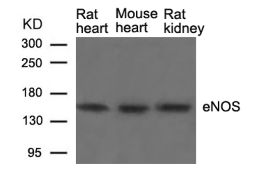 Western blot - eNOS (Ab-1177) Antibody from Signalway Antibody (21170) - Antibodies.com