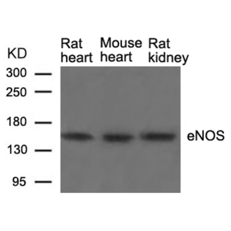 Western blot - eNOS (Ab-1177) Antibody from Signalway Antibody (21170) - Antibodies.com