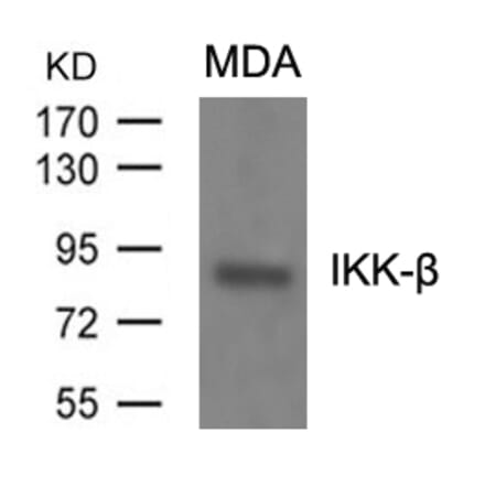 Western blot - IKK-b (Ab-199) Antibody from Signalway Antibody (21305) - Antibodies.com