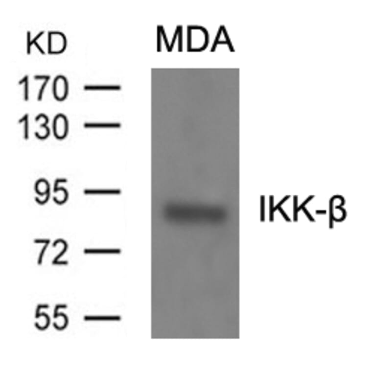 Western blot - IKK-b (Ab-199) Antibody from Signalway Antibody (21305) - Antibodies.com