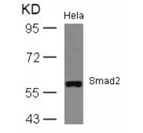 Western blot - Smad2 (Ab-467) Antibody from Signalway Antibody (21322) - Antibodies.com