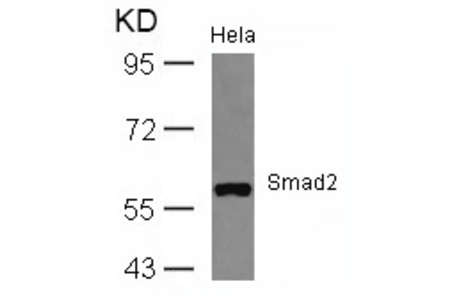 Western blot - Smad2 (Ab-467) Antibody from Signalway Antibody (21322) - Antibodies.com