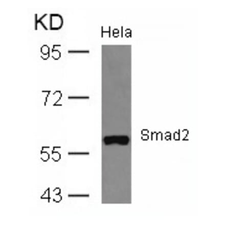 Western blot - Smad2 (Ab-467) Antibody from Signalway Antibody (21322) - Antibodies.com