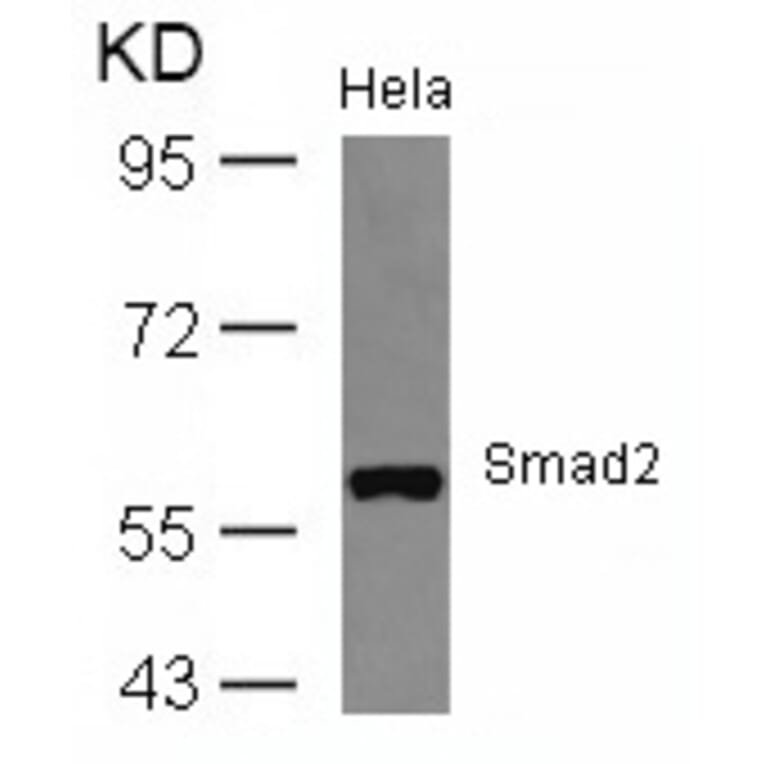 Western blot - Smad2 (Ab-467) Antibody from Signalway Antibody (21322) - Antibodies.com