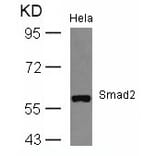 Western blot - Smad2 (Ab-467) Antibody from Signalway Antibody (21322) - Antibodies.com