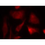 Immunofluorescence - Smad2 (Ab-467) Antibody from Signalway Antibody (21322) - Antibodies.com