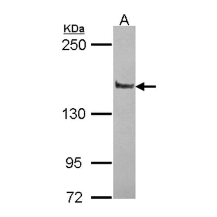 Liprin alpha 1 antibody from Signalway Antibody (22432) - Antibodies.com