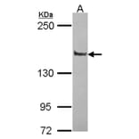 Liprin alpha 1 antibody from Signalway Antibody (22432) - Antibodies.com