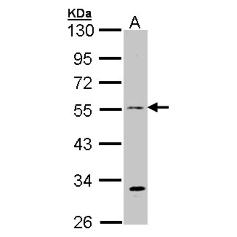 beta Tubulin 3 antibody from Signalway Antibody (23104) - Antibodies.com