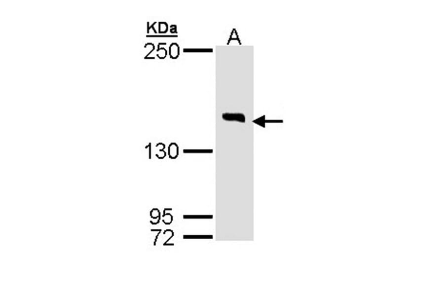 DIP2 homolog B antibody from Signalway Antibody (23145) - Antibodies.com