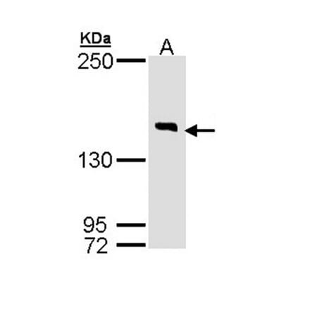 DIP2 homolog B antibody from Signalway Antibody (23145) - Antibodies.com