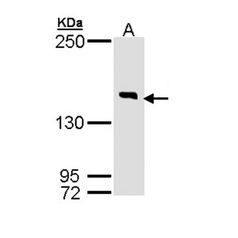 DIP2 homolog B antibody from Signalway Antibody (23145) - Antibodies.com