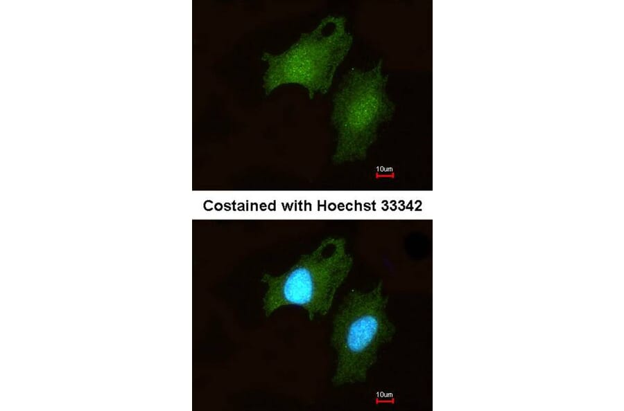 Immunofluorescence - DIP2 homolog B antibody from Signalway Antibody (23145) - Antibodies.com