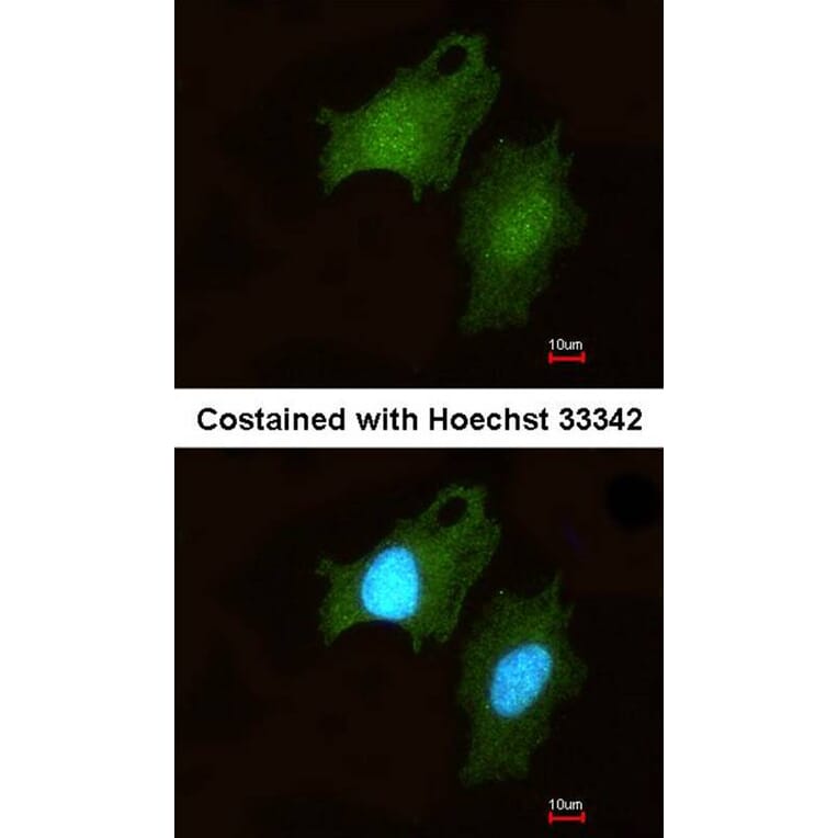 Immunofluorescence - DIP2 homolog B antibody from Signalway Antibody (23145) - Antibodies.com