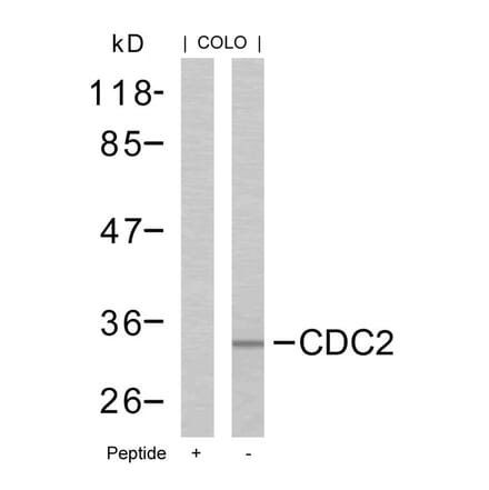 Western blot - CDC2 (Ab-161) Antibody from Signalway Antibody (21152) - Antibodies.com