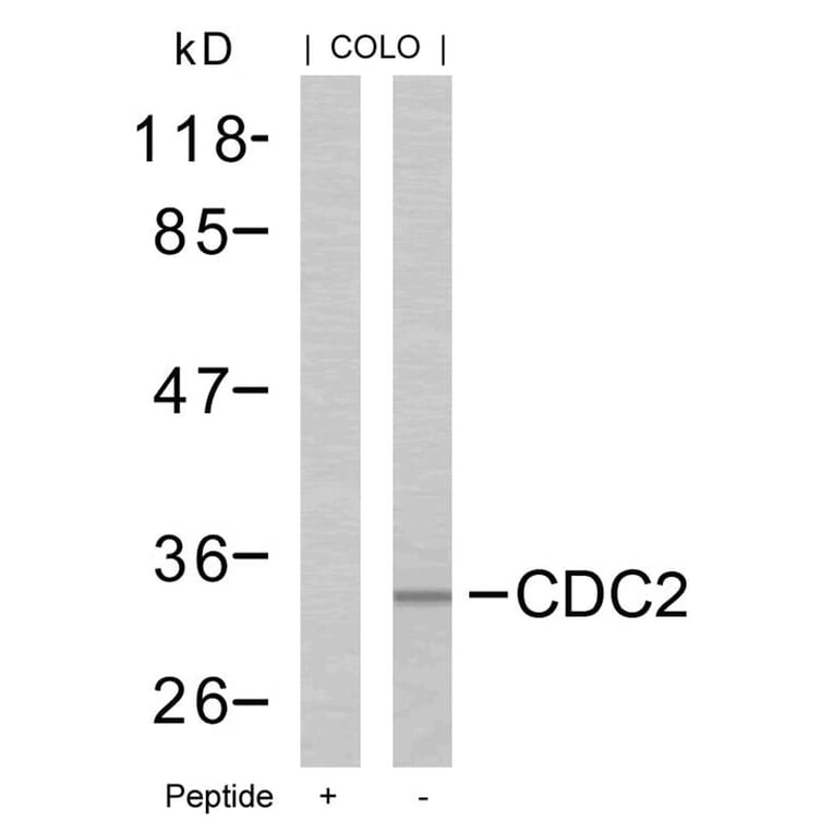 Western blot - CDC2 (Ab-161) Antibody from Signalway Antibody (21152) - Antibodies.com