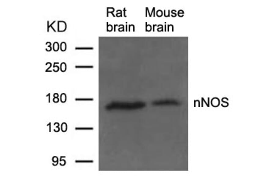 Western blot - nNOS (Ab-852) Antibody from Signalway Antibody (21159) - Antibodies.com
