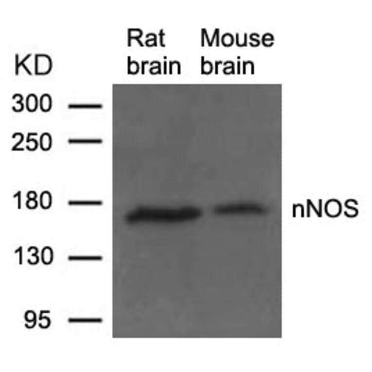 Western blot - nNOS (Ab-852) Antibody from Signalway Antibody (21159) - Antibodies.com