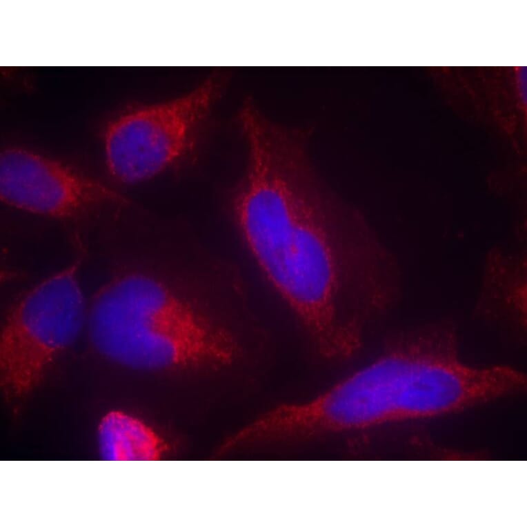 Immunofluorescence - FLT3 (Ab-591) Antibody from Signalway Antibody (21187) - Antibodies.com