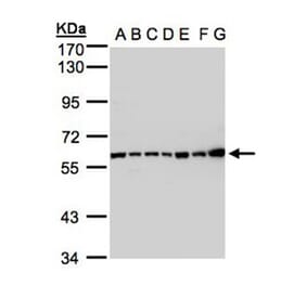 Complement C2 antibody from Signalway Antibody (22971) - Antibodies.com