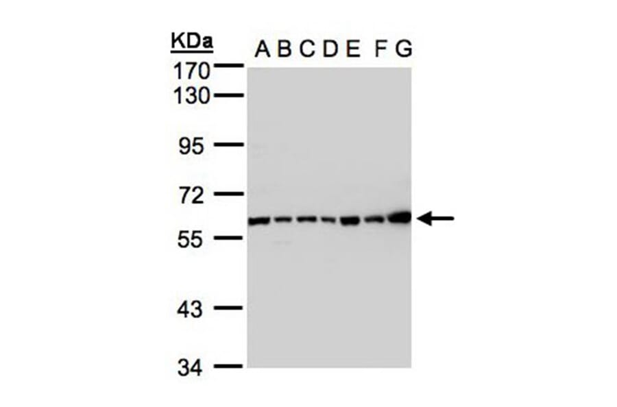 Complement C2 antibody from Signalway Antibody (22971) - Antibodies.com