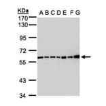 Complement C2 antibody from Signalway Antibody (22971) - Antibodies.com