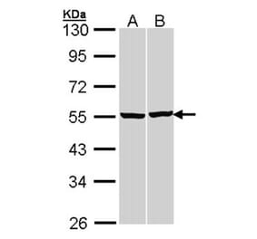 beta Tubulin antibody from Signalway Antibody (23176) - Antibodies.com