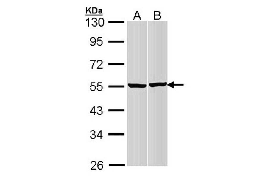 beta Tubulin antibody from Signalway Antibody (23176) - Antibodies.com