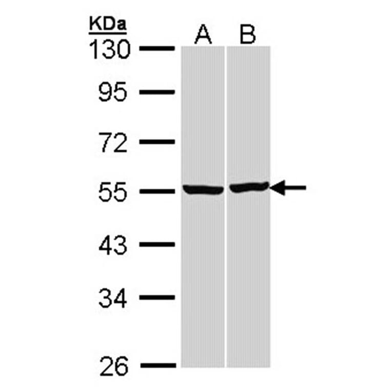 beta Tubulin antibody from Signalway Antibody (23176) - Antibodies.com