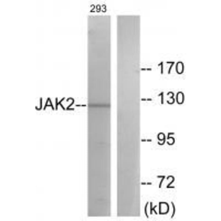 Western blot - JAK2 (Ab-570) Antibody from Signalway Antibody (33137) - Antibodies.com