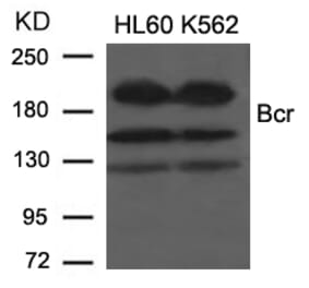 Western blot - Bcr (Ab-177) Antibody from Signalway Antibody (21197) - Antibodies.com
