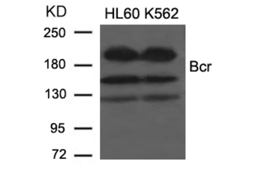 Western blot - Bcr (Ab-177) Antibody from Signalway Antibody (21197) - Antibodies.com