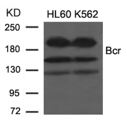 Western blot - Bcr (Ab-177) Antibody from Signalway Antibody (21197) - Antibodies.com