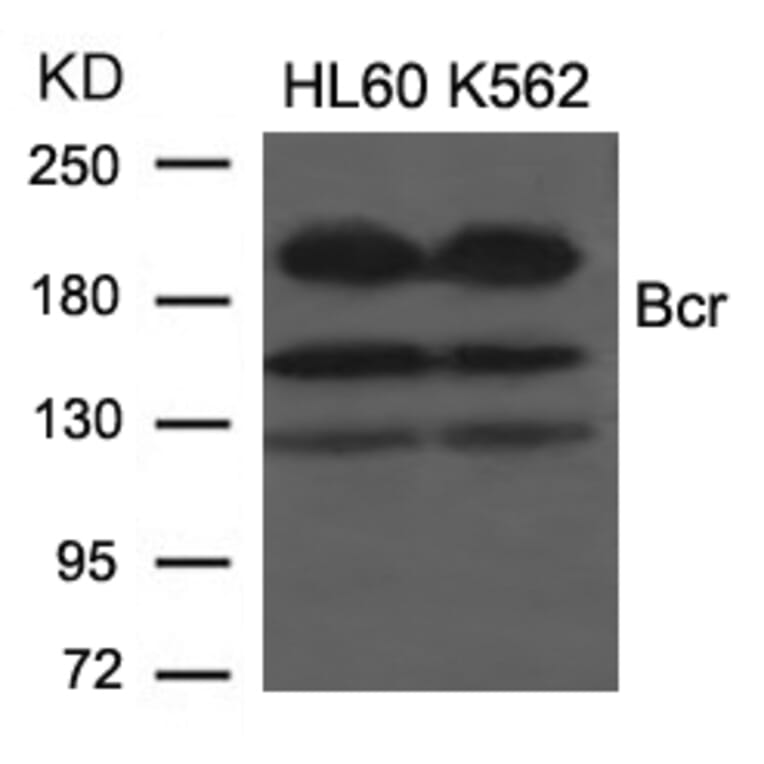 Western blot - Bcr (Ab-177) Antibody from Signalway Antibody (21197) - Antibodies.com