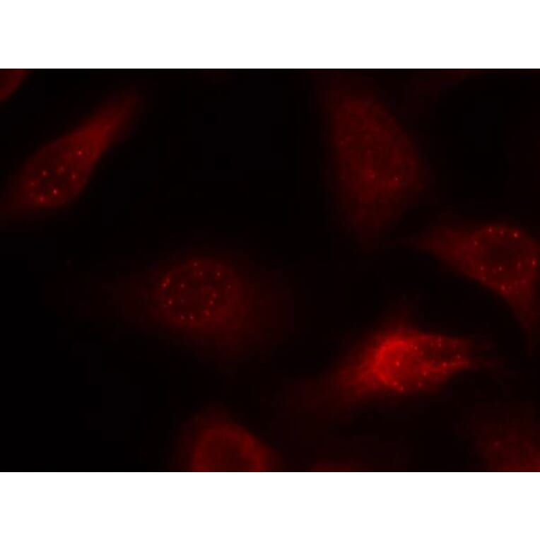 Immunofluorescence - APP (Ab-668) Antibody from Signalway Antibody (21204) - Antibodies.com